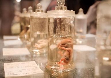 36岁AMH低在北京做试管婴儿要花多少钱？哪里可以做？